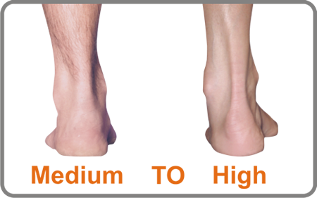 The Cavus Foot has a medium to high arch