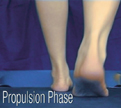 B Quad from The Quadrastep® System is for the Mild Pes Planus foot- Propulsion Phase