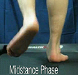 F Quad from The Quadrastep® System is for the Severe Pes Planovalgus foot - Midstance Phase