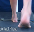 A Quad from The Quadrastep® System is for the Severe Pes Cavus foot - Contact Phase