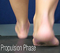 D Quad from The Quadrastep® System is for the Moderate Pes Planus foot- Propulsion Phase