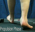 F Quad from The Quadrastep® System is for the Severe Pes Planovalgus foot- Propulsion Phase